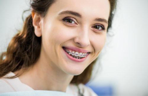 close up of happy woman with braces on teeth smiling in dental clinic